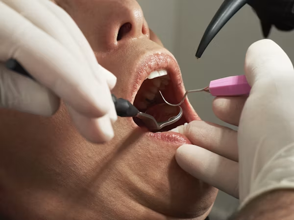 Poți muri de la un implant dentar? Ghid complet despre riscuri reale, complicații grave și măsuri de siguranță