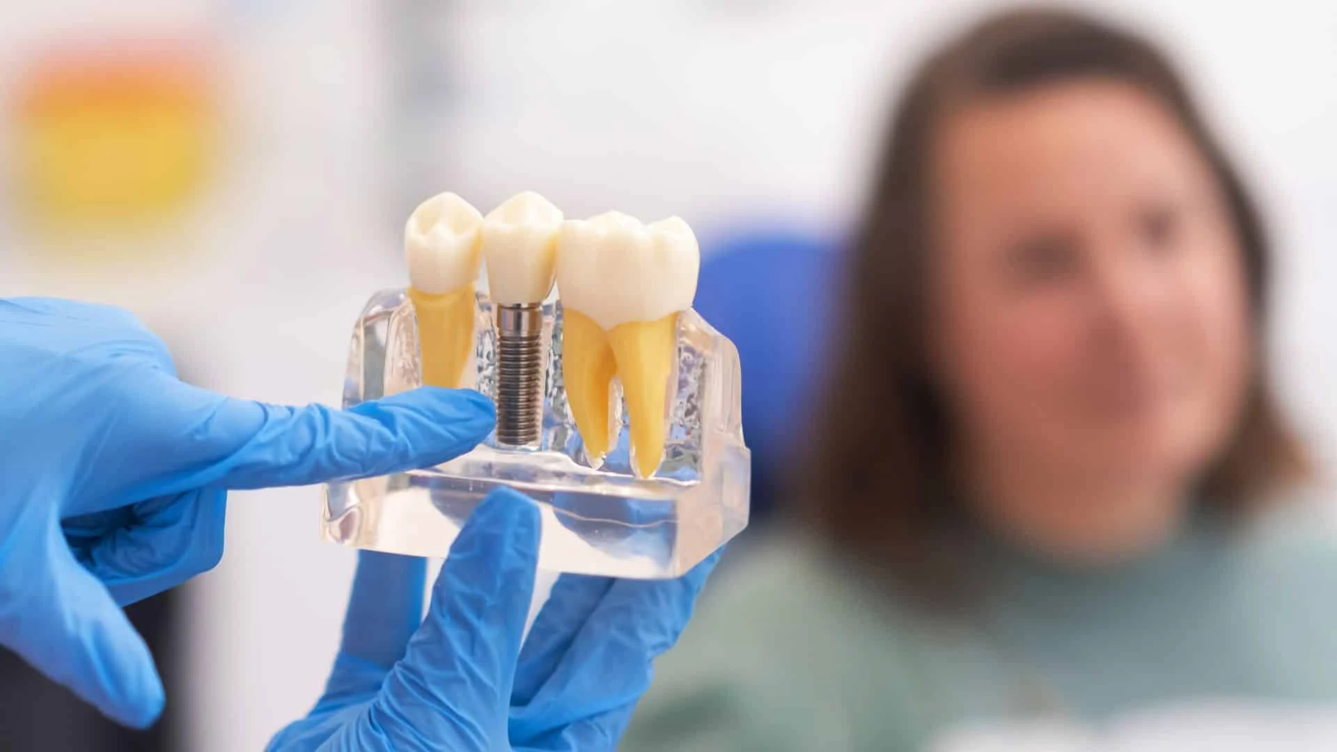 Când nu se poate face implant dentar: contraindicații, lipsa osului și soluțiile pe care le ai când intervenția nu este posibilă